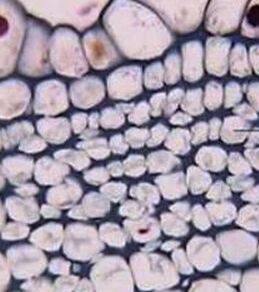 厚角細胞 厚角細胞