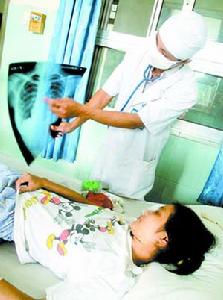 妊娠合併肺結核