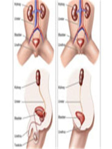 小腸氣痛 小腸氣痛