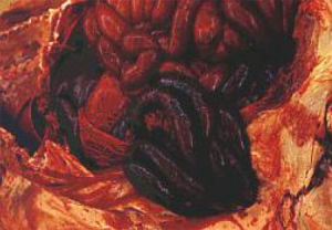 豬迴腸炎剖解病變特徵