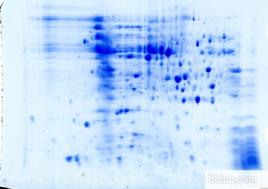 二維凝膠電泳 二維凝膠電泳