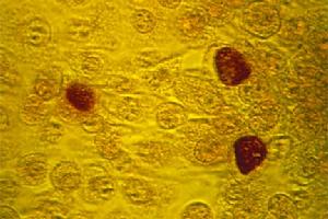 衣原體感染 衣原體感染