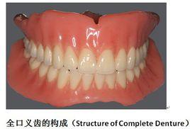 全口義齒