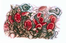 血液凝固 血液凝固