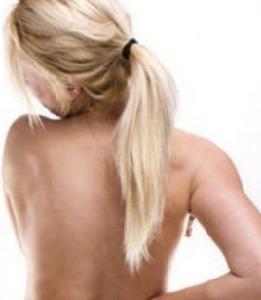 女性強直性脊柱炎 女性強直性脊柱炎