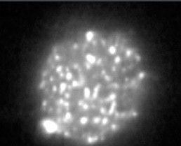 瑪士撒拉蟲 瑪士撒拉蟲