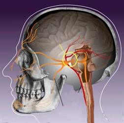 繼發性三叉神經痛 繼發性三叉神經痛