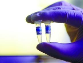 診斷試劑 診斷試劑