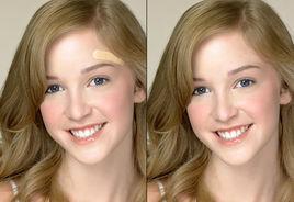 變色創可貼 變色創可貼