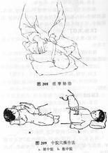 胃腸道脹氣按摩方法