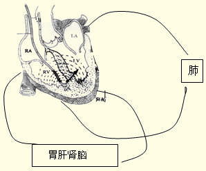 心源性呼吸困難 心源性呼吸困難