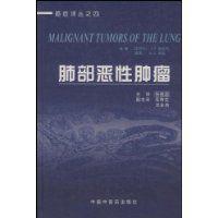 肺部惡性腫瘤 肺部惡性腫瘤