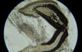 雙陰道蟲屬 雙陰道蟲屬