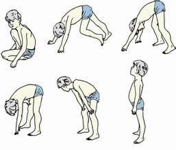 貝克型進行性肌營養不良