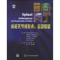 脊柱關節形術 脊柱關節形術