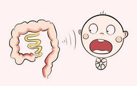 乙狀結腸冗長症 乙狀結腸冗長症