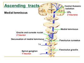 內側丘系交叉 內側丘系交叉