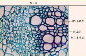 有限維管束 有限維管束