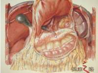 胰腺分裂 胰腺分裂