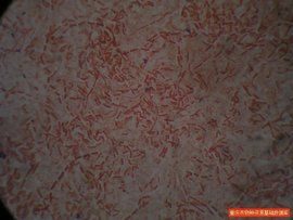 嗜熱脂肪芽孢桿菌 嗜熱脂肪芽孢桿菌