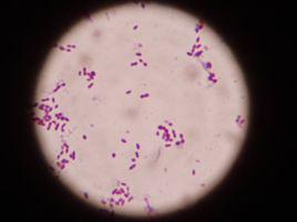 肺炎鏈球菌[乳桿菌目細菌]