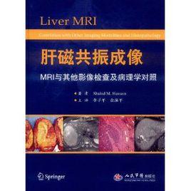 肝磁共振成像 肝磁共振成像
