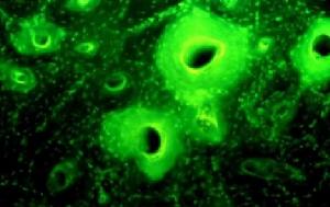 科學家在紫外線下觀測發現1500年前努比亞人骨骼中富含四環素