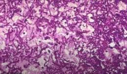 多顏色鏈黴菌 多顏色鏈黴菌