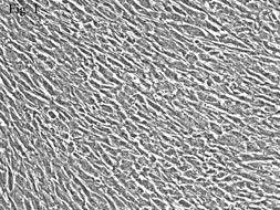 STEVENS-JOHNSON綜合症