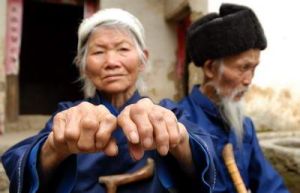 豬氟中毒 豬氟中毒