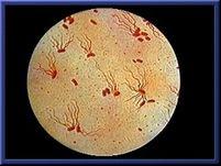 地方性斑疹傷寒 地方性斑疹傷寒