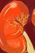 腎病綜合徵 腎病綜合徵