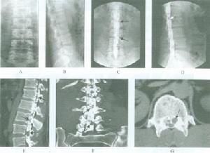 （圖）影像學診斷