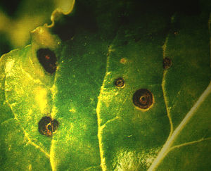 月單胞菌屬 月單胞菌屬