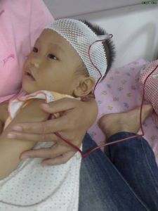 海洋性貧血 海洋性貧血