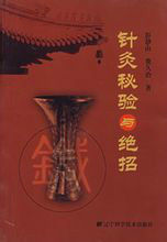 針炙秘驗與絕招 針炙秘驗與絕招