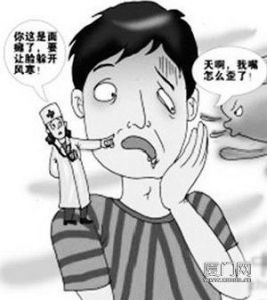 創傷性面癱 創傷性面癱