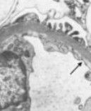 微量白蛋白 微量白蛋白