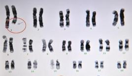 染色體突變 染色體突變