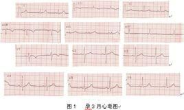 逆鐘向轉位 逆鐘向轉位