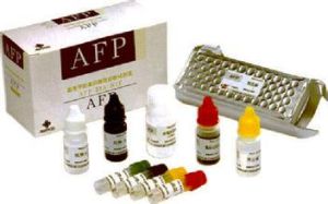 AFP[甲胎蛋白]