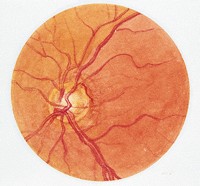 眼底檢查 眼底檢查