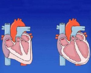 心功能分級 心功能分級