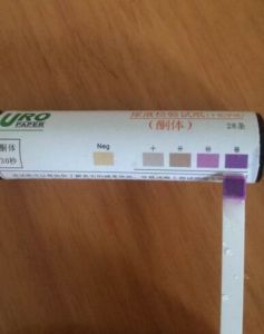 尿酮試紙 尿酮試紙