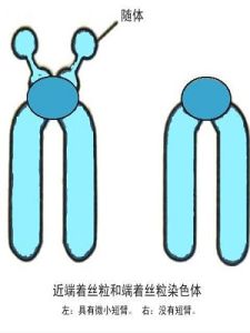 性別決定 性別決定