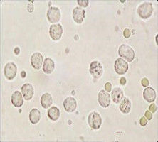 尿白細胞