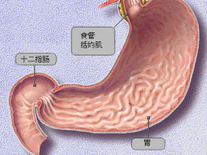 膽汁返流性胃炎