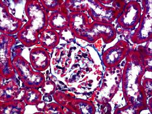 masson染色 masson染色