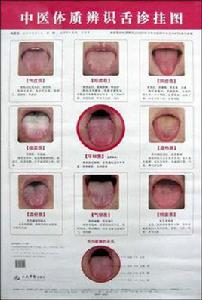 中醫體質辨識舌診掛圖
