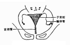（圖）正常子宮輸卵管造影